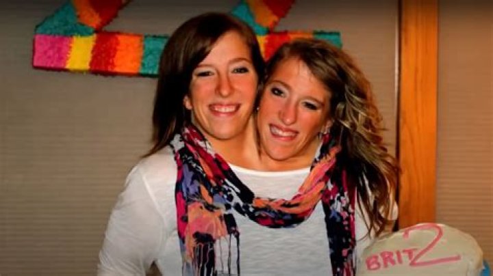 Exploring The Lives Of Abby And Brittany: Are They Still Alive?
